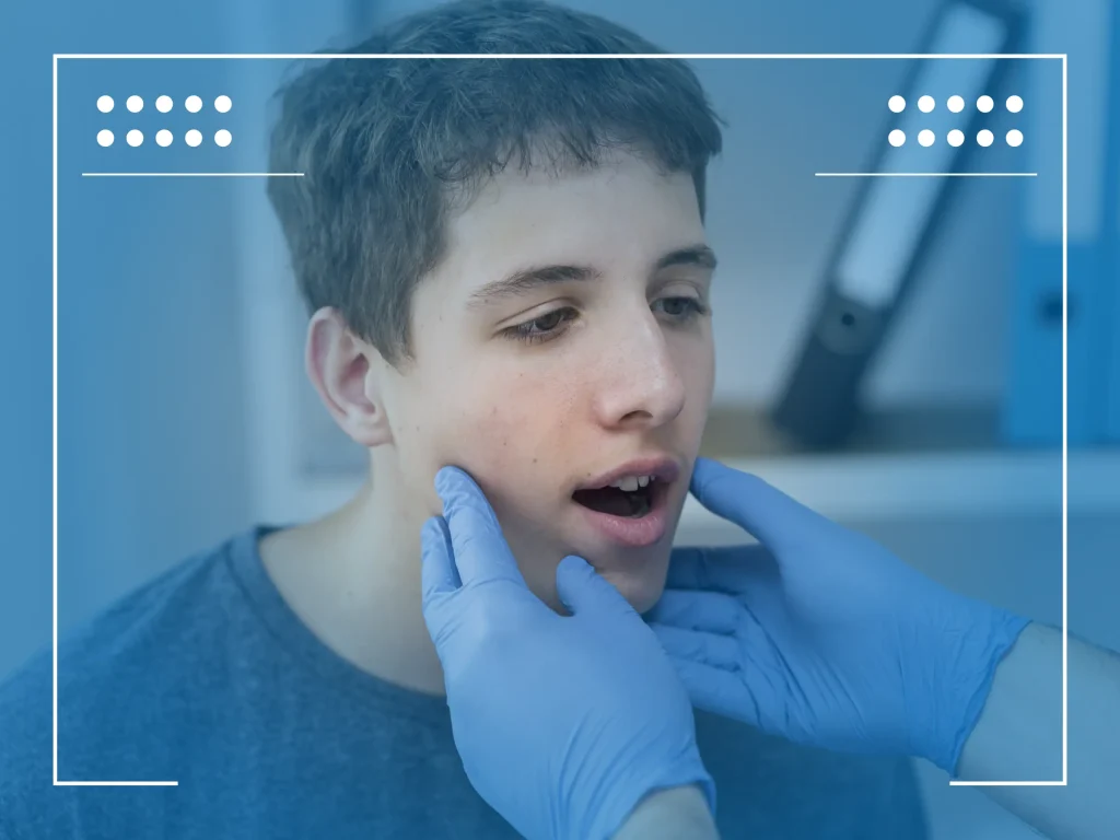 Jaw Cancer